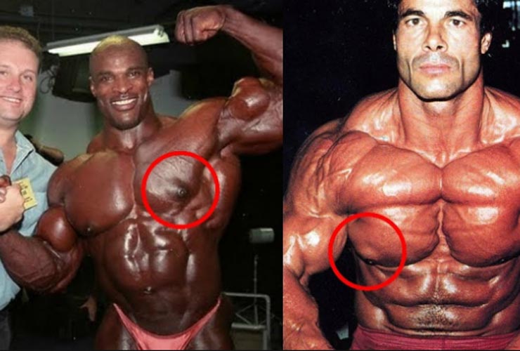 ¿Cómo reducir o eliminar la Luis Entrenador Personal