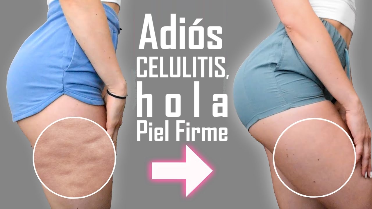Adiós Celulitis, Hola Piel Firme